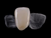  Kyoto Ceramic: A Revolutionizing Material for Dental Implants and High-Performance Cutting Tools!